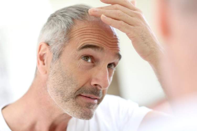 ثعلبة الشعر: أسباب وحلول