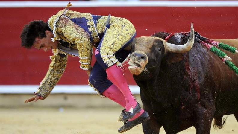 bull fighting injuries-اصابات مصارعة الثيران