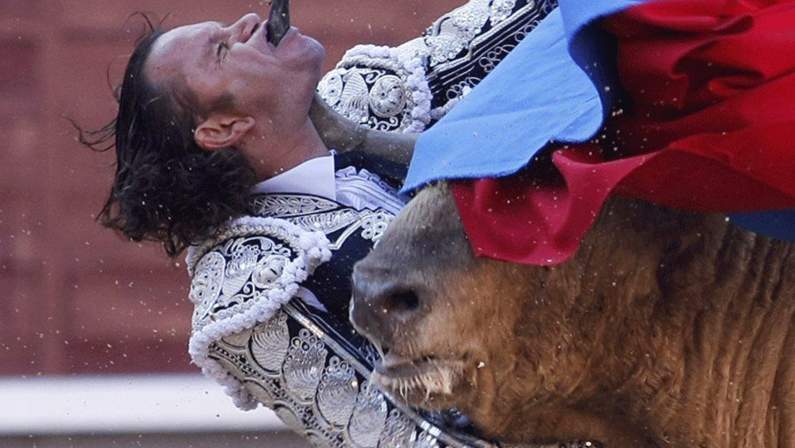 bull fighting injuries-اصابات مصارعة الثيران