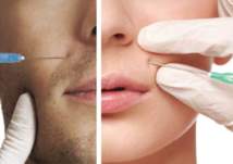 مليار درهم كلفة عمليات التجميل في الإمارات سنوياً