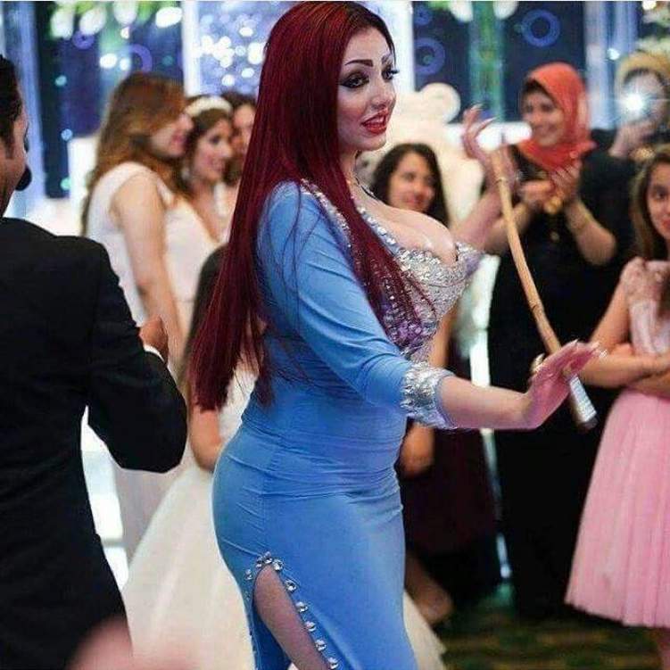 وفاة راقصة مصرية شابة أثناء جراحة تجميل