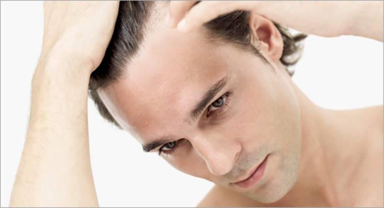 أفضل الطرق لعلاج تساقط الشعر عند الرجال