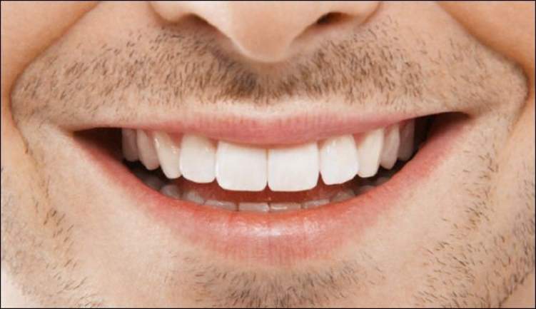 كيف تتخلص من اصفرار الأسنان في رمضان؟