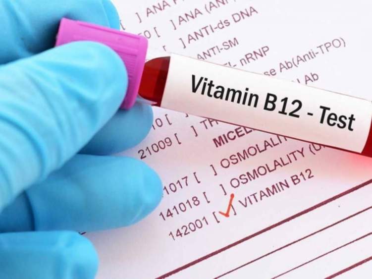 اكشف .. هل تعاني من نقص فيتامين الB12؟