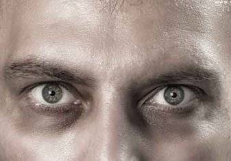 هل تفيد الكريمات في علاج الهالات السوداء حول العين؟ (فيديو)