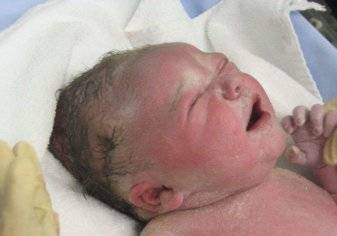 ولادة طفل مصاب بكورونا