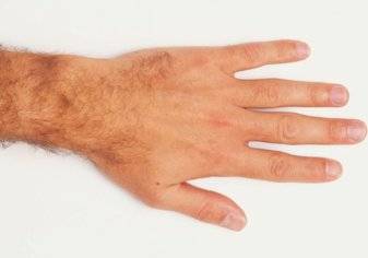 الرجال ذو الأصابع القصيرة أكثر عرضة للوفاة بكورونا