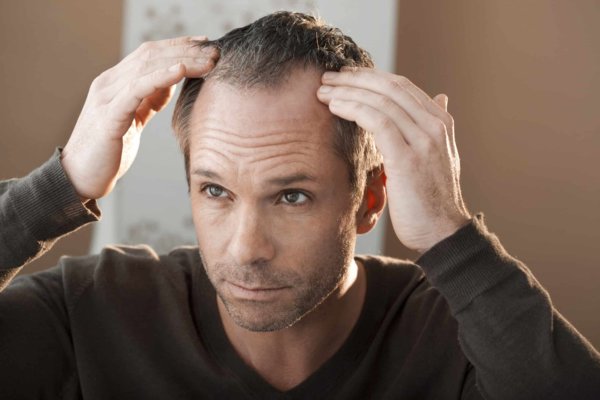 طريقة علاج الشعر الجاف والمتقصف