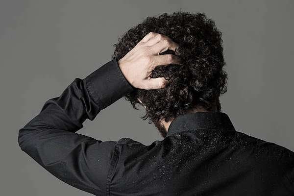 كيفية الوقاية من قشرة الشعر عند الرجال