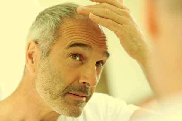 عوامل خطر تساقط الشعر